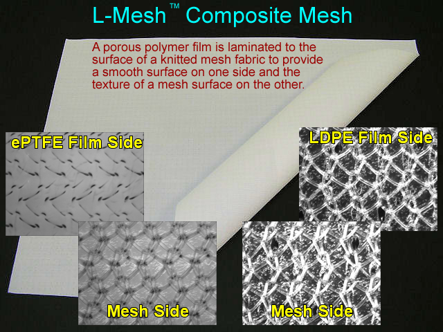 composite dual hernia polypropylene mesh